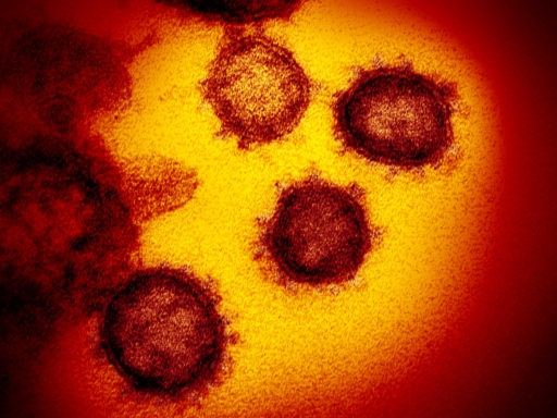 This transmission electron microscope image shows SARS-CoV-2, the virus that causes COVID-19, emerging from the surface of cells